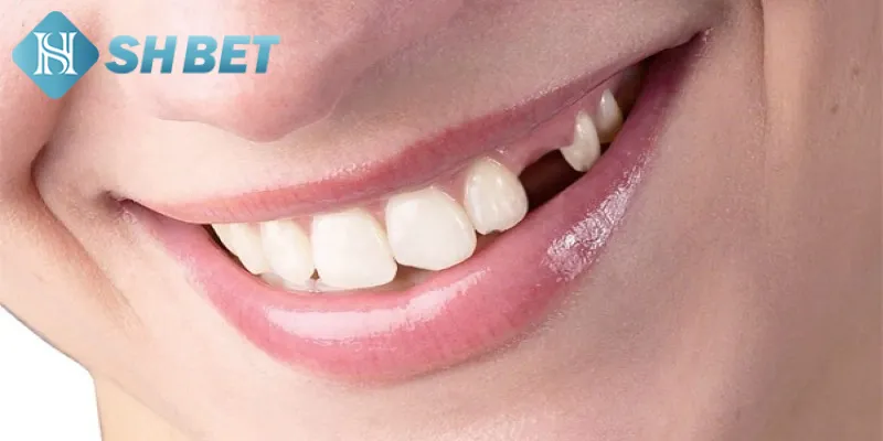 Giải mã điềm báo chi tiết các giấc chiêm bao rụng răng